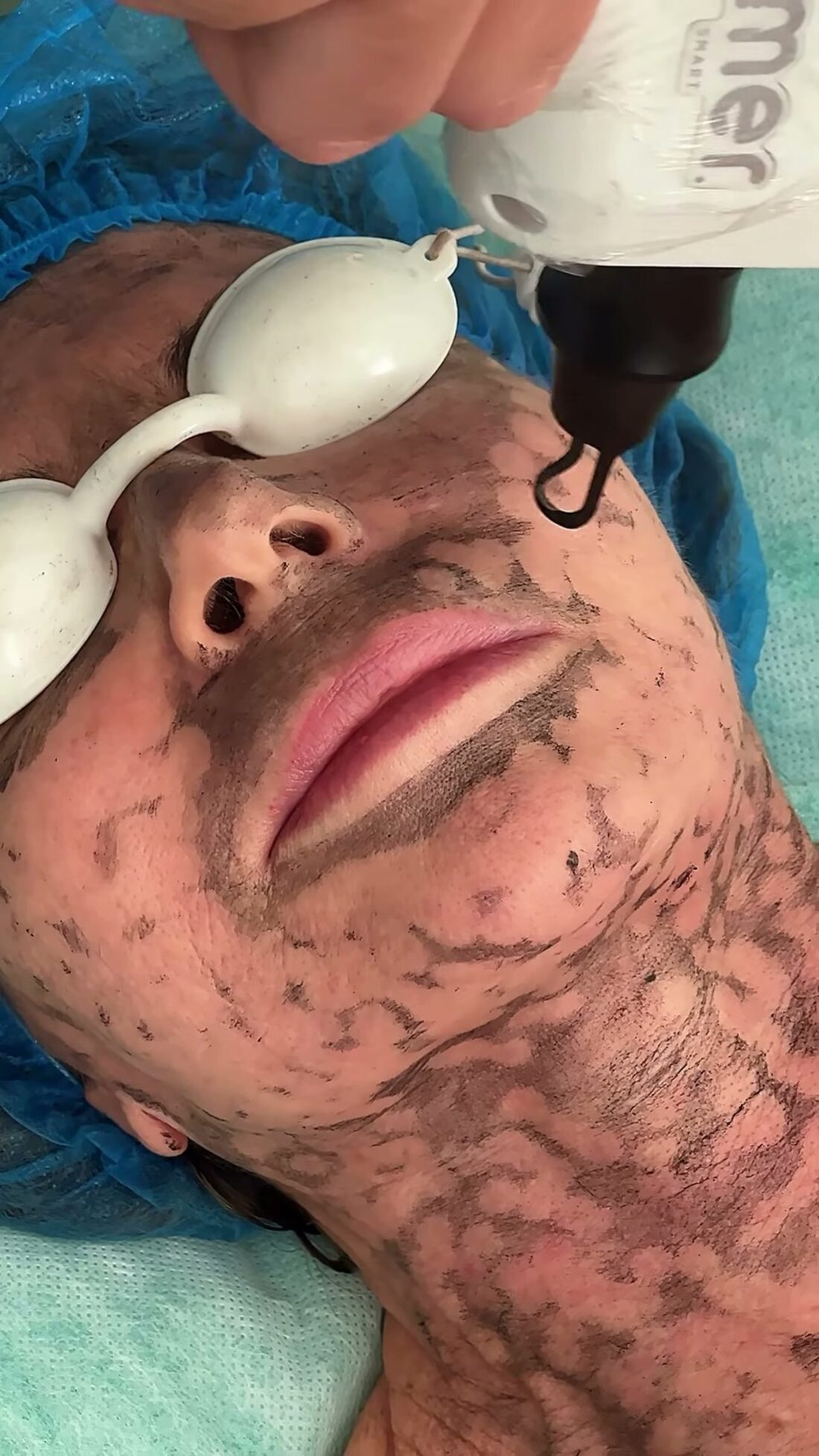 Faciais & Dermaplaning